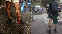 Represión y ataque a la libertad de expresión: más de 30 trabajadores de prensa heridos